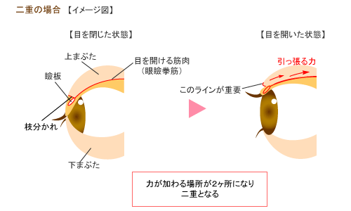 二重まぶたの仕組み 二重の場合