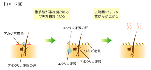 イメージ図：わきがの原因、メカニズム